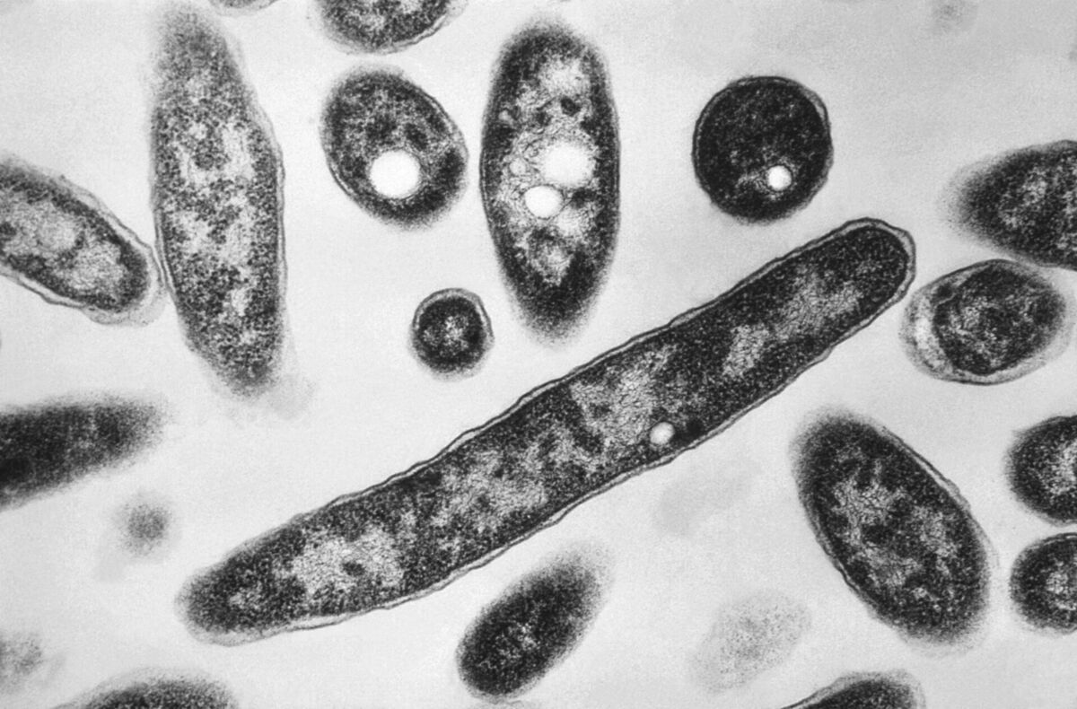 Legionella. Foto: scanpix/AP