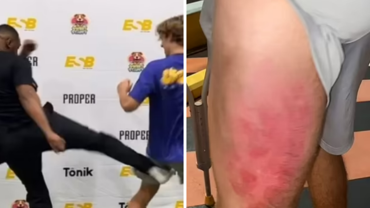 Foto: Ekrānšāviņi no "X"