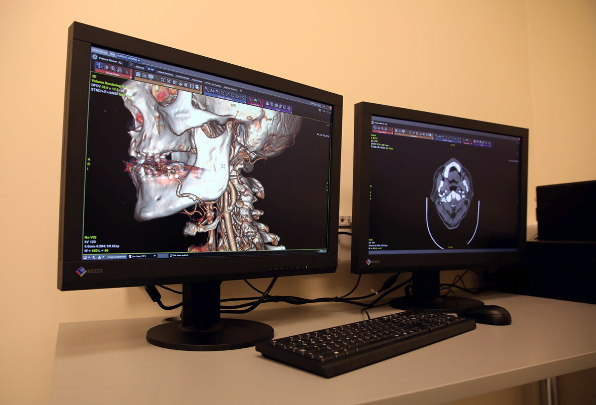Jaunākās paaudzes datortomogrāfs Rīgas Austrumu klīniskajā slimnīcā Foto: LETA