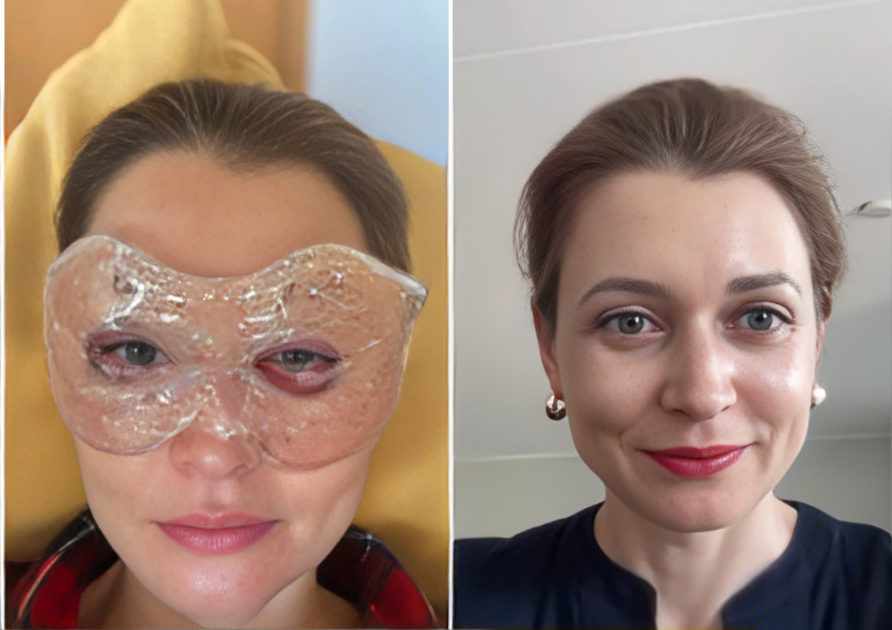 inga.springe/Instagram