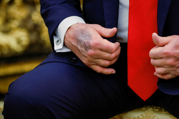 Zilums uz Donalda Trampa rokas. Foto: REUTERS/Brian Snyder