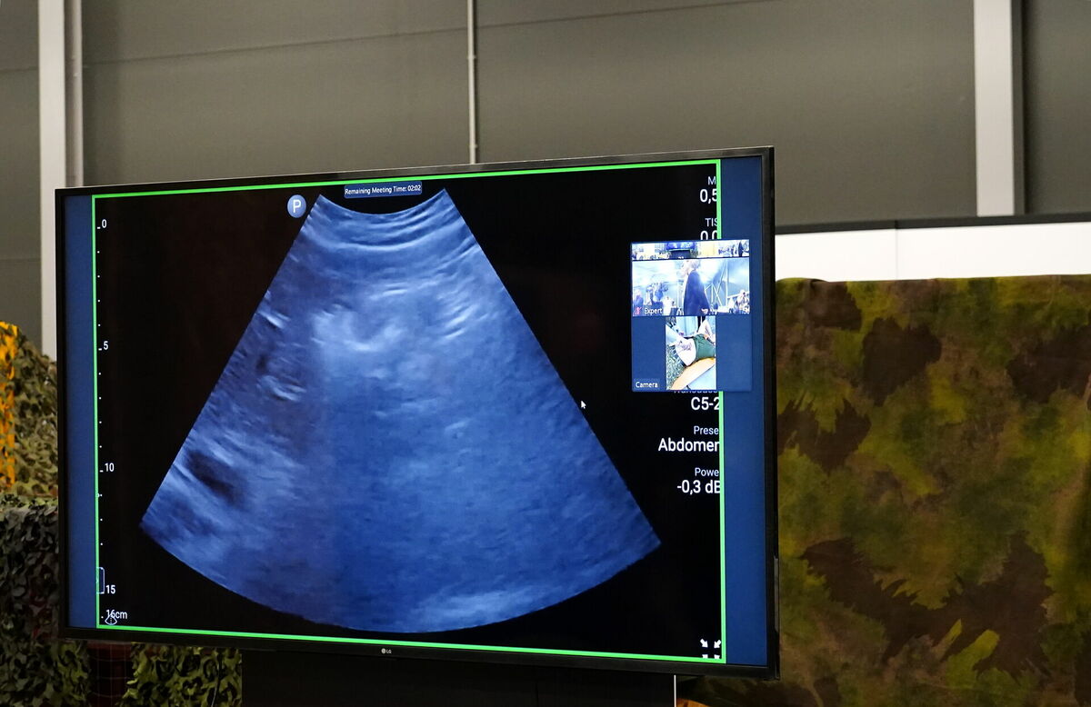 Ultrasonogrāfs. Foto: LETA