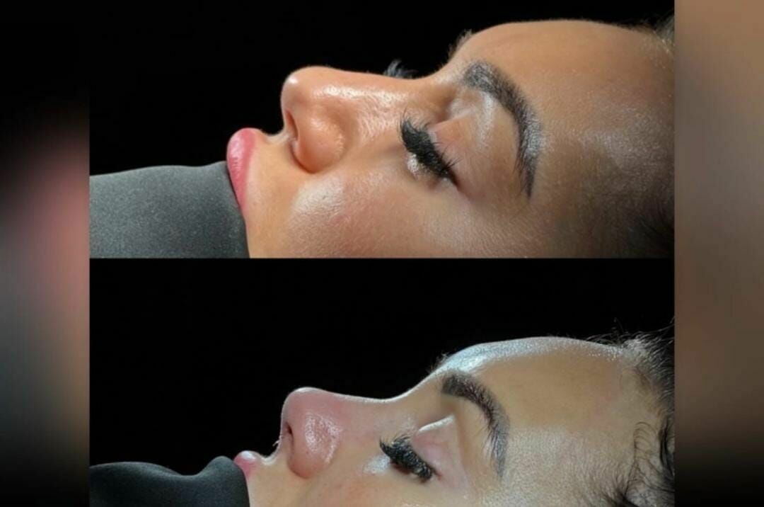 Foto: Instagram /@didrihsoonee